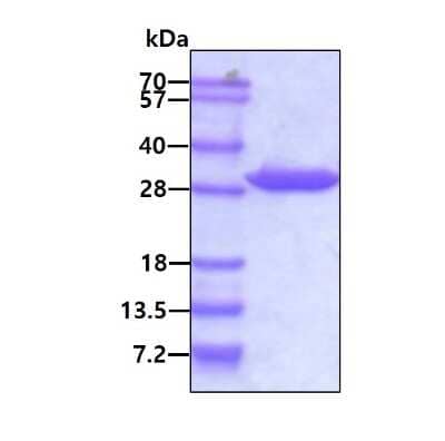 SDS-PAGE Recombinant Human 14-3-3 gamma Protein